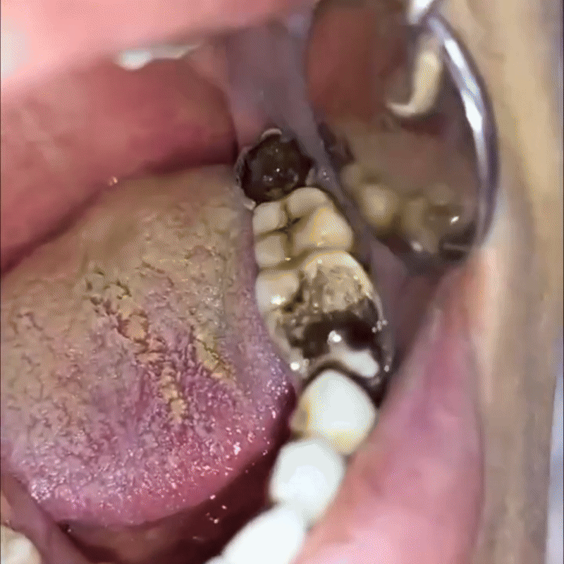 Poudre Minérale Dentaire – Pour Restauration & Soin des Dents